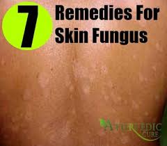 7 Essential Home Remedies For Skin Fungus Home Remedies For Skin Skin Infection Fungus Skin