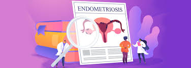 Learn about endometriosis, including possible treatments for this condition that causes pain and sometimes infertility in many women. Endometriosis And Diet Support Lipinutragen