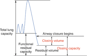 Image result for Functional Residual Capacity