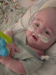 Pittsburgh residents and their experiences with stairs