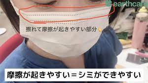 マスクの摩擦もシミになりますか とインスタライブ見た方から質問いただきました 2021 肌荒れ ニキビ ニキビ 色素沈着