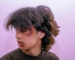 bruise my face" is out now this song and m.i.a. are two of the most  important songs i've written for myself and i hope they help you as much as  writing them