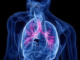 Menurut organisasi kesehatan dunia (who), paparan polusi udara juga menyebabkan sekitar 4,2 juta kematian di dunia setiap tahunnya. Paru Paru Berair Pulmonary Edema Simptom Punca Faktor Risiko Diagnosis Rawatan Ceriasihat
