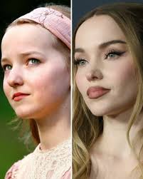 Dove Cameron Before and After: From 2008 to 2024
