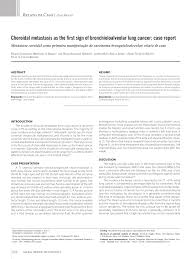 Some of these early signs and symptoms include: Pdf Choroidal Metastasis As The First Sign Of Bronchioloalveolar Lung Cancer Case Report