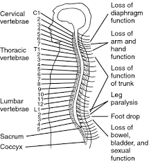 Quadriplegia Quadriplegia Tetraplegia Medical Dictionary