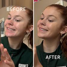 Skintuition!! This skin-first foundation is infused with hyaluronic acid  for deep hydration and SPF 30 for daily sun protection — making it a summer  must-have. Lightweight, breathable coverage that leaves your skin