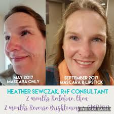 BeautyBio R45 The Reversal The product is a multi-phase retinol treatment  system designed to address signs of aging. It uses a patented 3-phase  system to gradually increase retinol concentration over a 45-day