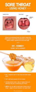 Get Rid Of Sore Throat Using Honey Sore Throat Soreness Health Remedies