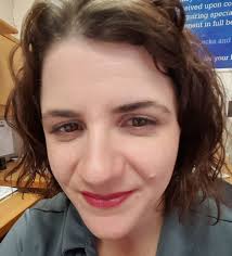 Are your lips chapped all the time can never get soft no matter what u use