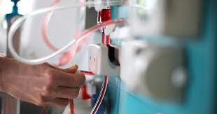 I often see patients in my office who refuse dialysis (should it become necessary) for their advancing kidney disease. Dialysis Procedure Types Risks Purpose National Kidney Foundation
