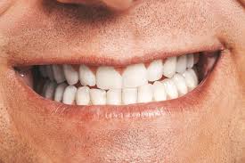 Read full profile you have probably heard that it takes fewe. Closeup Of Male Mouth Healthy Smile Creative Commons Bilder