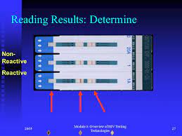However, those with a negative result but a recent exposure to hiv should get another test at least 3 months after the possible exposure. Overview Of Hiv Testing Technologies Ppt Video Online Download