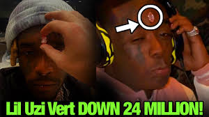 Off topic > lil uzi vert face diamond implant. Rgm2ulhdvj8dcm