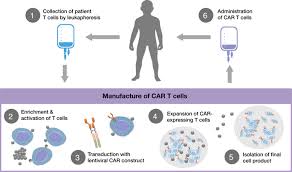 The presence of blood in the urine is usually a sign of bladder cancer, not colon cancer. The Journey To Car T Cell Therapy The Pediatric And Young Adult Experience With Relapsed Or Refractory B All Blood Cancer Journal X Mol