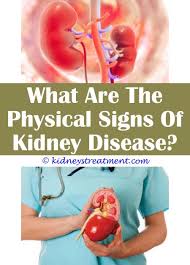 Kidney Disease Dogs Kidney Disease Recipes Kidney Disease Polycystic Kidney Disease