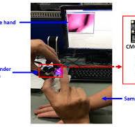 Vein Pattern Locating Technology for Cannulation: A Review ...