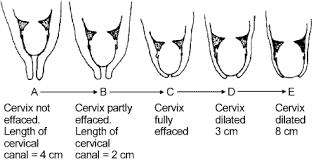 Stages Of Labor Nursing Considerations Interventions Nurseslabs Stages Of Labor Delivering A Baby Cervix