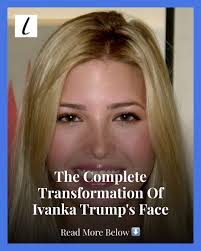 Many fans and experts have suggested that Ivanka Trump's teeth, nose, and  cheeks have undergone cosmetic work. Our surgical experts have their own  opinions.