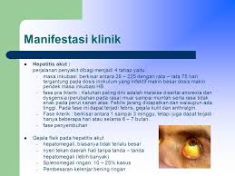 Mereka yang dijangkiti penyakit hepatitis b seperti darah, air liur, air mani, rembesan dari faraj, air mata, mukus, air kencing dan juga susu badan. Epidemiologi Hepatitis Ppt Download