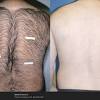 You might need a maintenance treatment every year or so to keep stray hairs from cropping up. Https Encrypted Tbn0 Gstatic Com Images Q Tbn And9gcraxihwuov4ohvgz8cafshpv Dch Mky9ln3z7kpil1cm77bmxl Usqp Cau