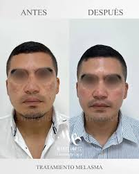 Centro de Dermatología y estética (@dermatologiayestetica_mym) • Instagram  photos and videos