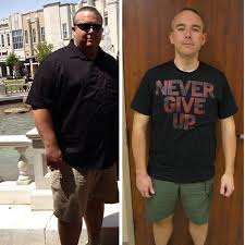 Pin On Weight Loss Surgery