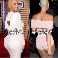 Pin On Celebrity Plastic Surgery