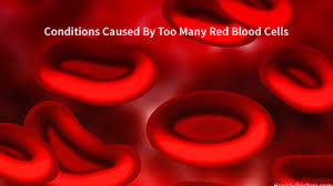Research of gaisbock's syndrome has been linked to polycythemia, relative erythrocytosis, hypertensive disease, myxedema, stasis. Too Many Red Blood Cells Can Lead To What Condition Health Checkup