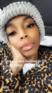 Lip Fillers: Your 2025 Transformation Guide💋