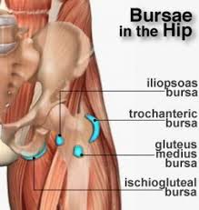 Hip Bursae Anatomy Of The Hip A Bursa Is A Small Sac Of Fluid That Acts As A Cushion Between Bones And T Bursitis Hip Iliopsoas Bursitis Trochanteric Bursitis
