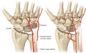 Image result for Pisiform Bone