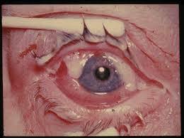 Image result for Gonococcal Conjunctivitis