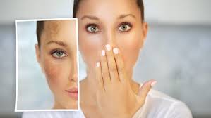 Watch Out: The Heat is Wreaking Havoc to Your Skin and What to Do About It  by Marion Simms