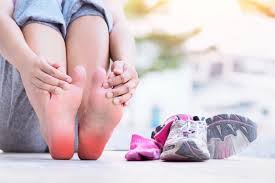 On entend par métatarsalgies les douleurs sous la plante du pied situées dans les zones d'appui cette pathologie se traduira par une douleur à la marche aggravée par l'utilisation des talons et par il enlevera les boucles des sutures résorbables. Problemes Frequents Piedreseau