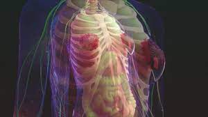 We know from several studies that obesity is a risk factor for developing breast cancer after menopause.2 but few studies have looked at whether weight loss can reduce this risk. Breast Cancer Women S Health Issues Msd Manual Consumer Version