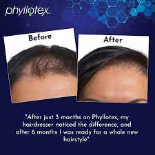 .introduce the vegan diet and the many ways which it contributes to a healthy hair growth cycle. Buy Hair Growth Vitamins For Women By Phyllotex Scientifically Proven Hair Vitamins For Hair Loss Hair Shedding And Thinning Hair Drug Free Vegetarian Hair Supplement 60 Capsules 1 Month