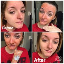 Calm redness with the Series 2 Red Light Mask for faster skin recovery.  @becky_wren , runner up of the 2025 before and after competition.