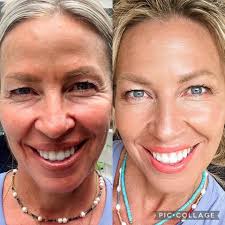 Live Like You Love Yourself