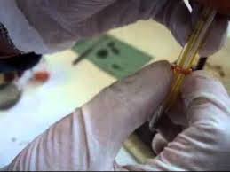 The apparatus itself resembles a glass test tube with an attached. Measuring Melting Point Of Aspirin Using Thiele Tube Youtube