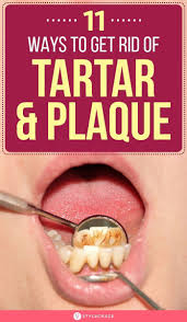 It is used in some kinds of toothpaste as an additional ingredient but can be purchased separately. How To Remove Tartar And Plaque From Teeth 11 Home Remedies Teeth Health Oral Health Care Health And Wellbeing