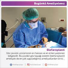 Goz Cevresi Yuzumuzun En Hassas Ve En Erken Yaslanan Bolgesidir Bu Yuzden Goz Kapagi Estetik Blefaroplasti Ameliyati Da En Cok Uygulad 2020 Estetik Yuzler Bilgi