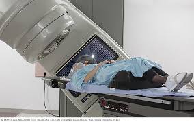 Radiation Therapy Mayo Clinic