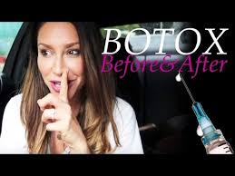 'an infection is one of the complications that can occur after having. Scrotox Results Pictures Download Videos Mp3 And Mp4 Aozora Jitsuwa