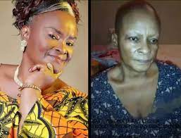 Actress, ify onwuemene reportedly down with endometrial cancer. 12 Months After She Was Diagnosed With Cancer See How Nollywood Actress Ify Onwuemene Has Changed Photos