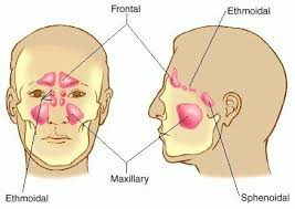 Image result for Maxillary Sinus