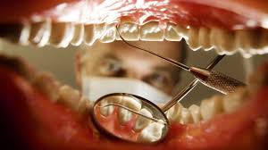 We did not find results for: How Often Do You Need To See A Dentist Bbc Future