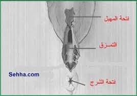 الخلاصه في خياطة المنطقه الحساسه بالصور منتدى الحياة الزوجية دليل النساء المتزوجات الثقافة الزوجية والعائلية