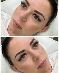 Lip Tattoo Transformation My client desired enhanced lip definition and a  boost of colour. This treatment will heal to a soft, natural tint, creating  a subtle yet refined result that complements her