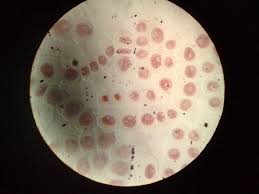 Resultado de imagen de OBSERVACIÃ“N DE CÃ‰LULAS EN MITOSIS EN AJO